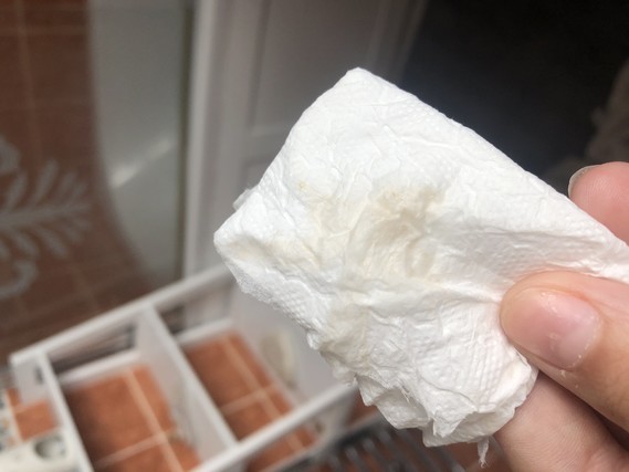 Pink When I Wipe Am I Pregnant