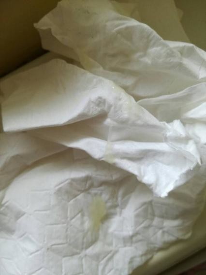 Pink Discharge 38 Weeks