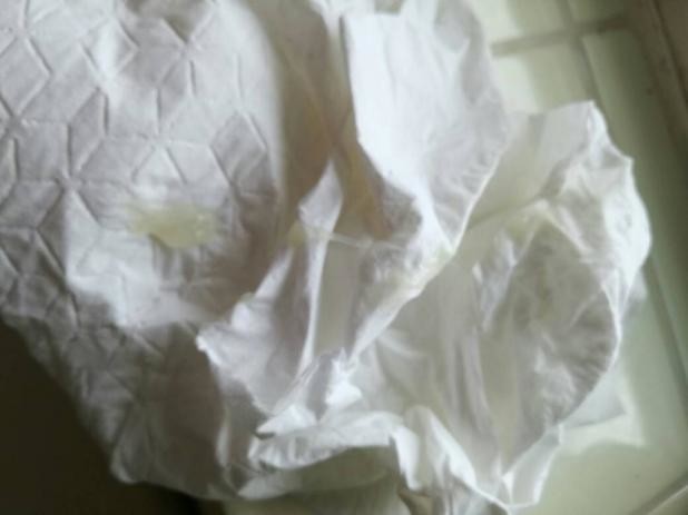 Pink Discharge 38 Weeks