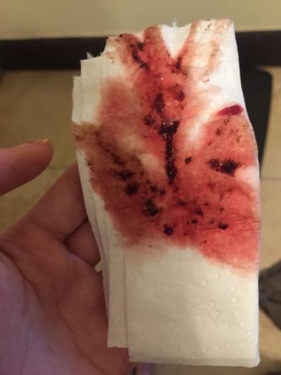 Miscarriage Period Bleeding Warning Graphic