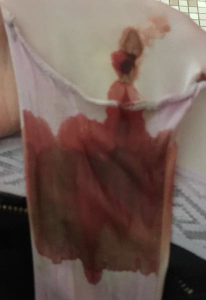 Miscarriage Period Bleeding Warning Graphic