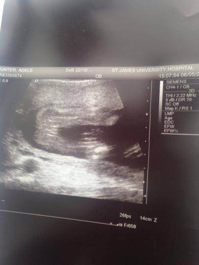 Confirmed Boy at 16 week scan!