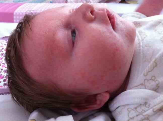 e45 cream for newborn babies
