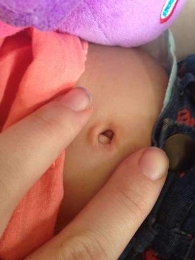 baby belly button black stuff