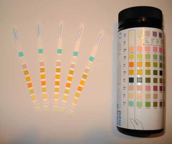 Siemens Urine Test Strips Colour Chart