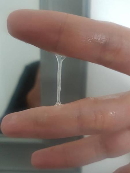 Matokeo ya picha ya image of egg like discharge