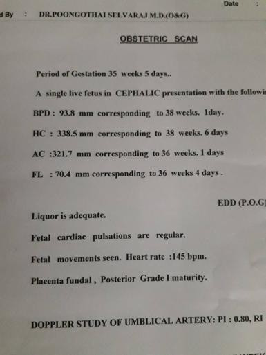 how to identify baby gender from heartbeat