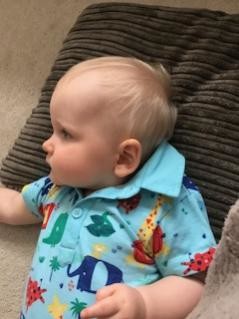 9 month old babies head shape | Netmums