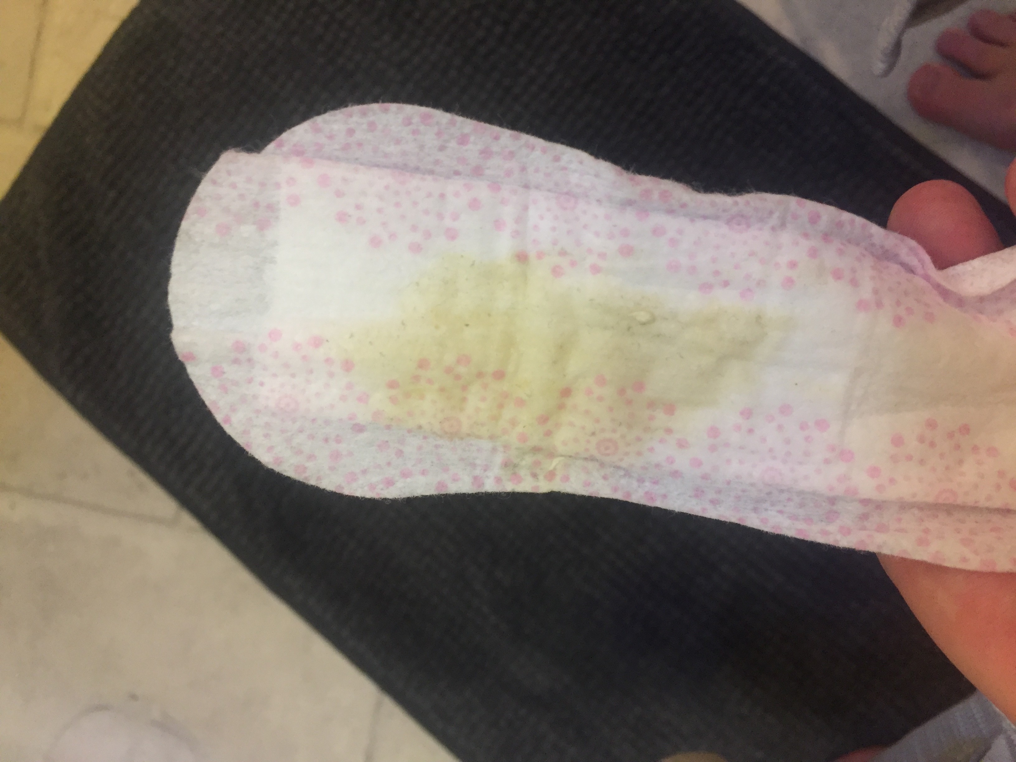 Leaking amniotic fluid? (TMI alert) | Netmums Leaking amniotic fluid? (TMI alert) | Netmums