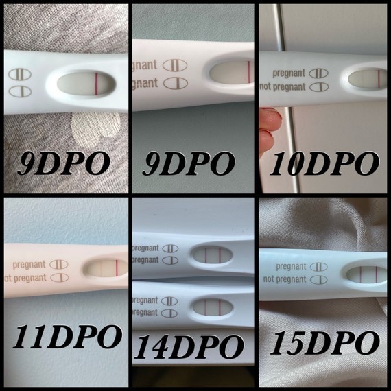 Help For People With Frer Lines