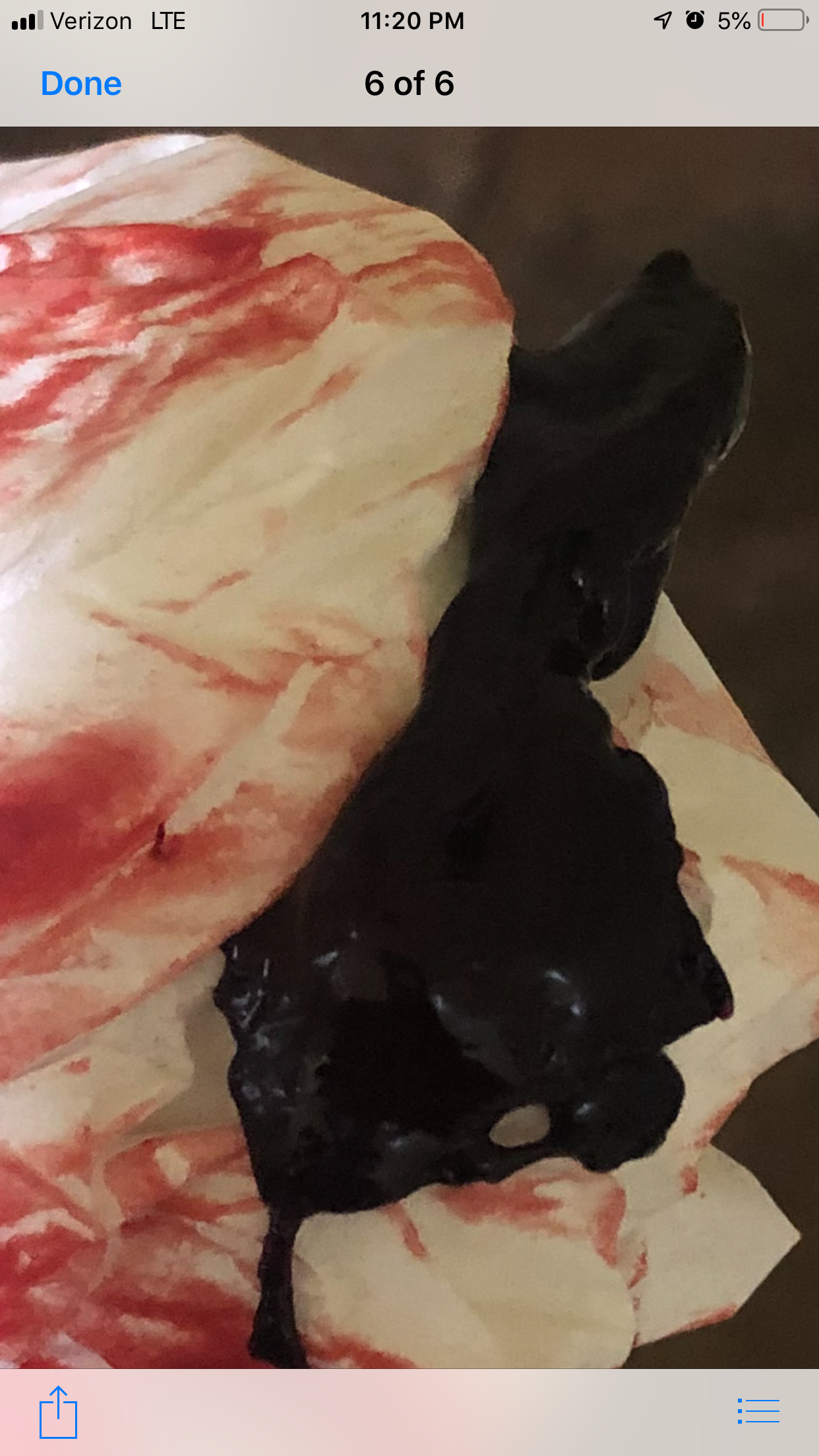 Get Large Blood Clot Week After Birth لم يسبق له مثيل الصور Tier3 Xyz Free HD Wallpaper Large Blood Clot Week After Birth لم يسبق له مثيل الصور Tier3 Xyz For Android Free