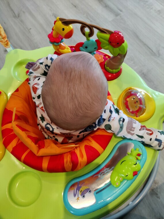 infant misshapen head infant misshapen head