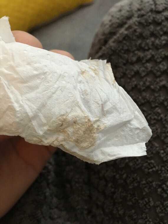 Implantation Bleeding But Negative Pregnancy Test Implantation Bleeding But Negative Pregnancy Test