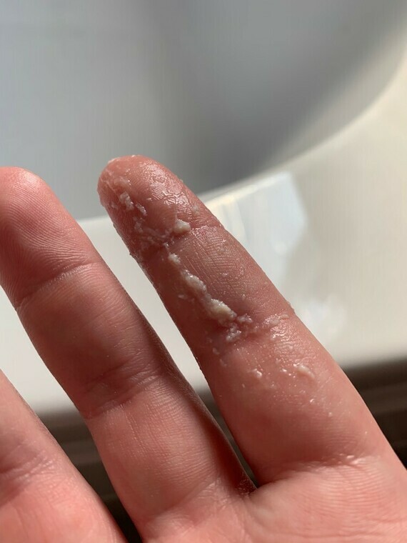 White Tissue Paper Like Discharge After Scan