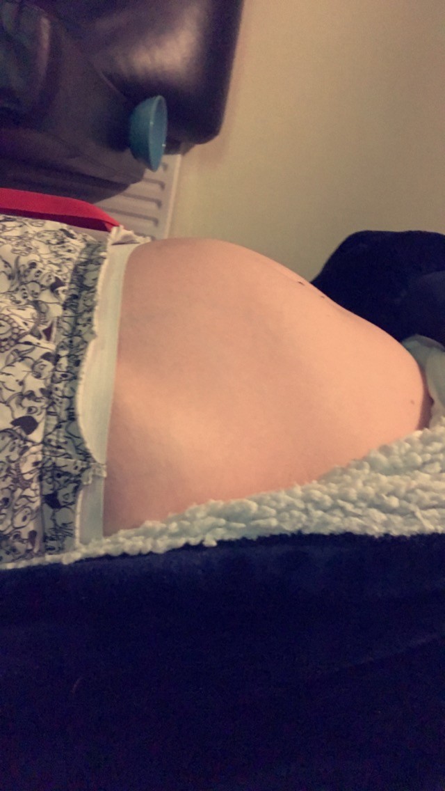 Bloating At 7 Days After Ovulation Netmums