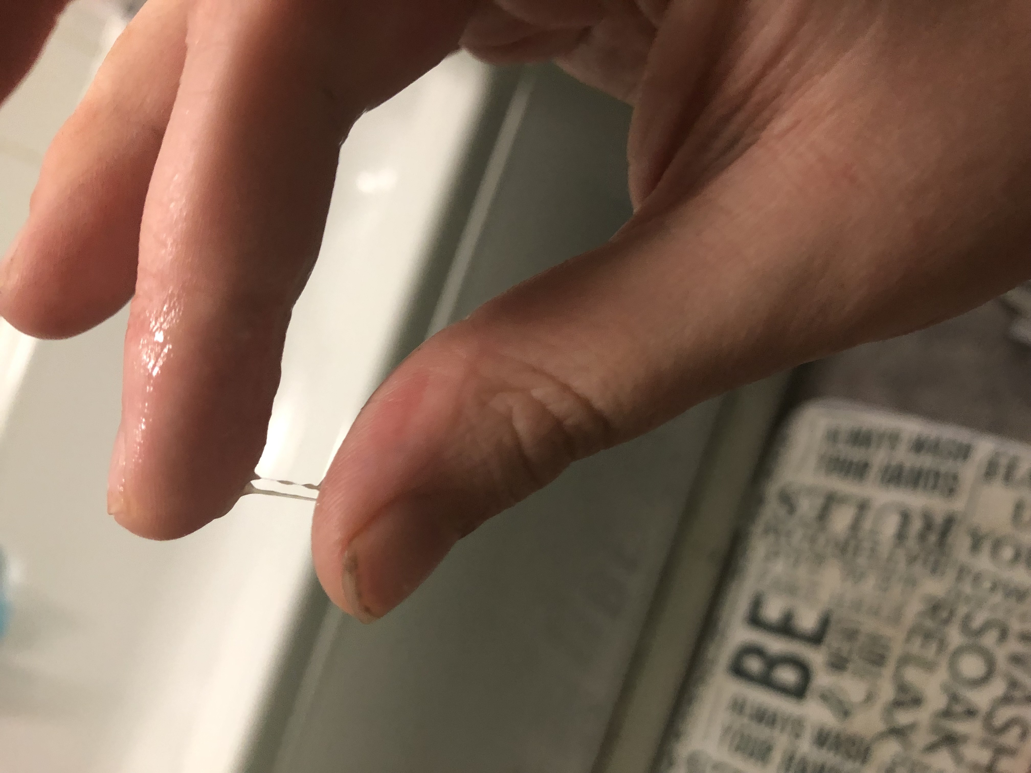 pix Tooth Abscess While Pregnant Netmums welcome to dangerous neoseeker xyz