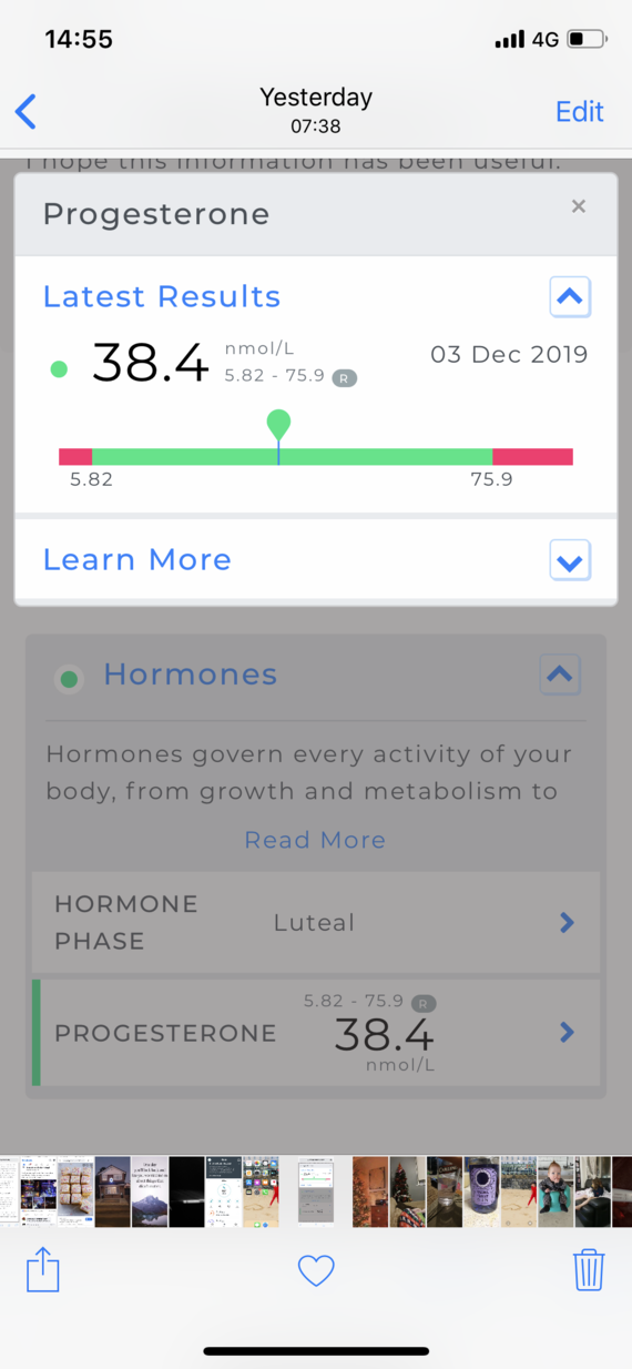 Day 21 progesterone levels