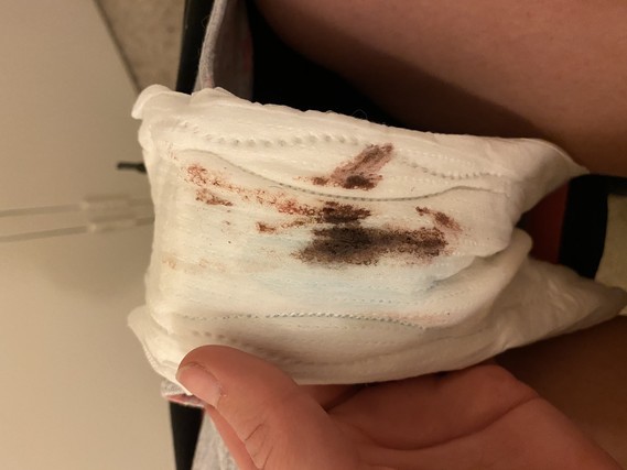 Implantation Bleeding Warning Tmi Graphic